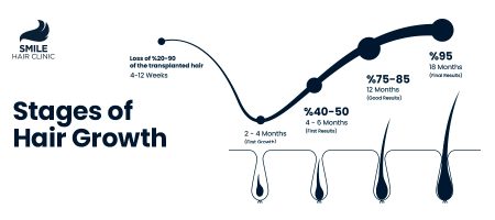 STAGES-OF-HAIR-GROWTH